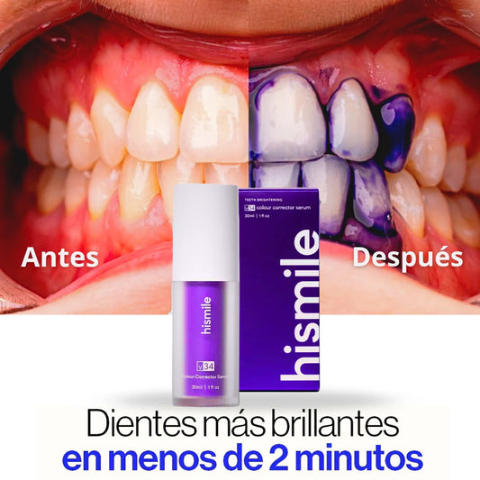 Blanqueador Dental V34 - ¡Dientes más blancos al instante!